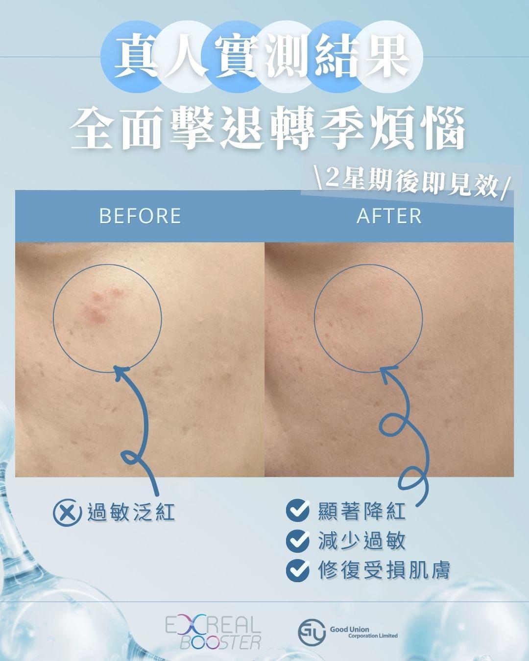 真人實測:B&A