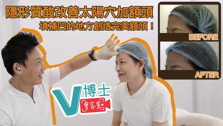【V博士會客室】隱形質酸改善太陽穴及額頭?填補凹的地方創造完美額頭!同樣面部問題的女生可以參考一下!