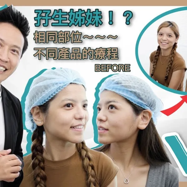 【V博士會客室】罕有系列～孖生姊妹相同部位不同產品的療程！刺激膠原增生VS隱形質酸！